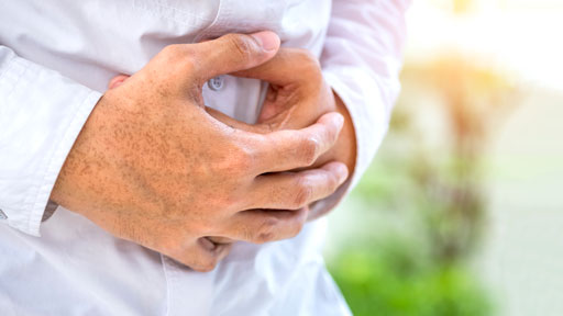 About Crohn's Disease
