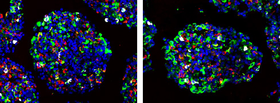 Organoids