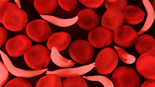 ohapi principles with sickle cell