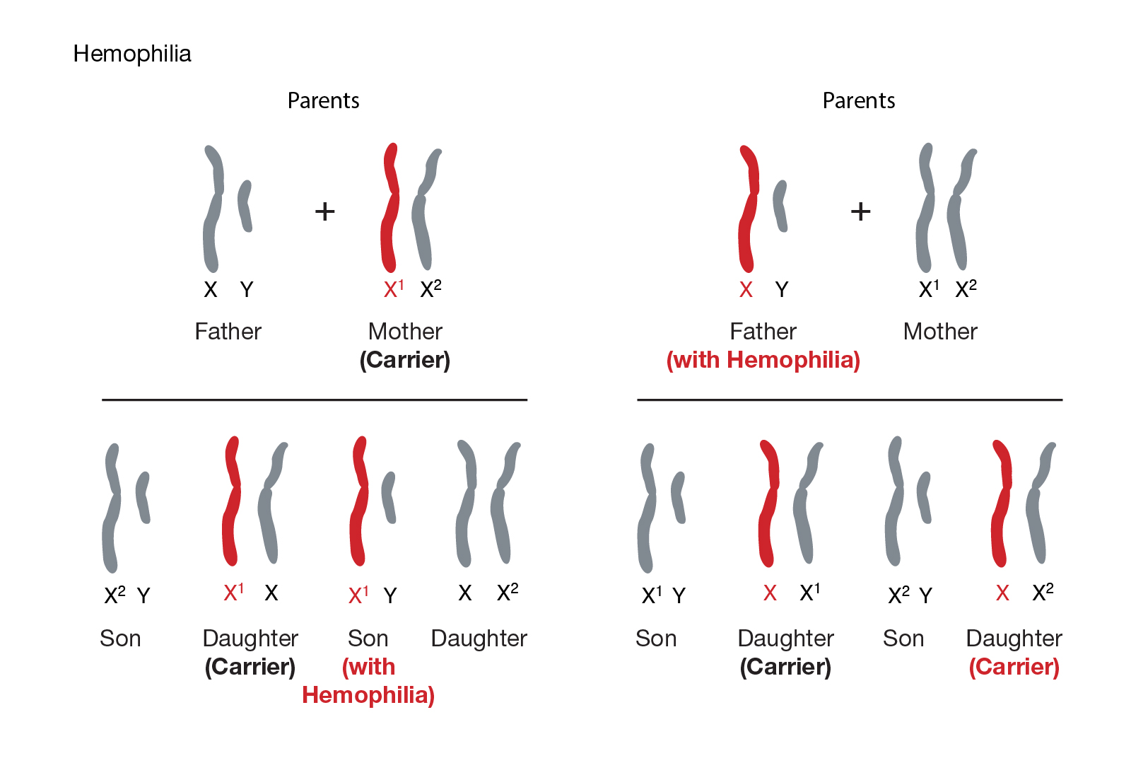 Hemophilia Karyotype